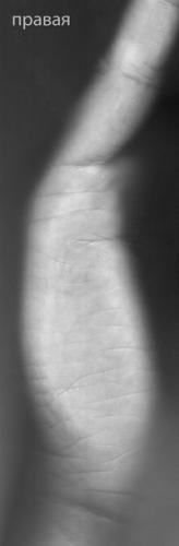 ������������� �����������