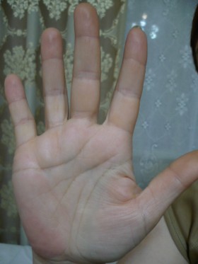 ������������� �����������